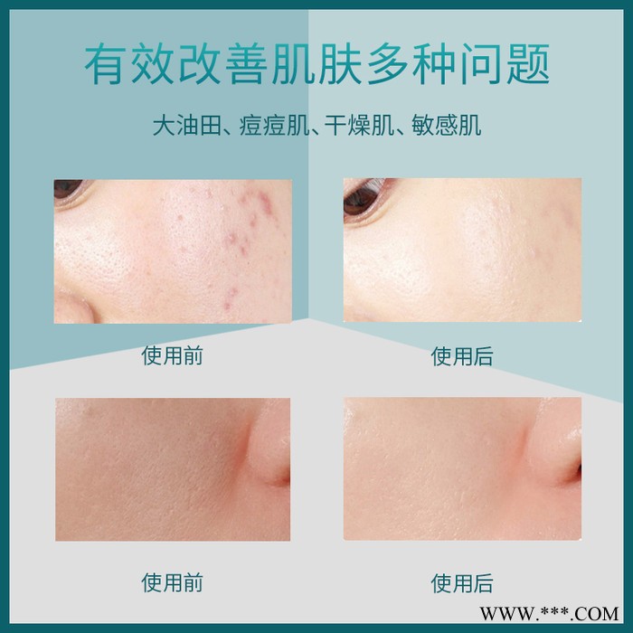 注氧仪新品上市美容仪美容仪器 补水仪喷雾图2