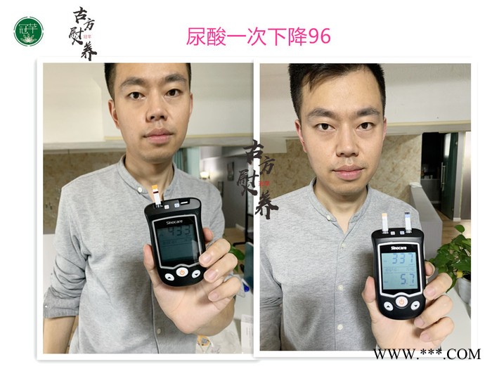 毕节拔罐减肥加盟连锁店图2