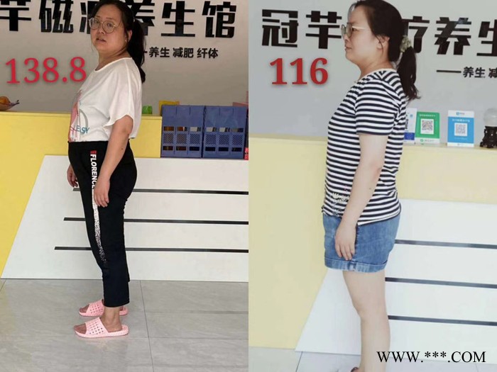 毕节拔罐减肥加盟连锁店图4