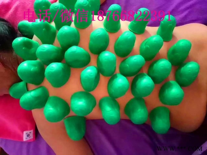 圣康源 硅胶拔罐针灸图3