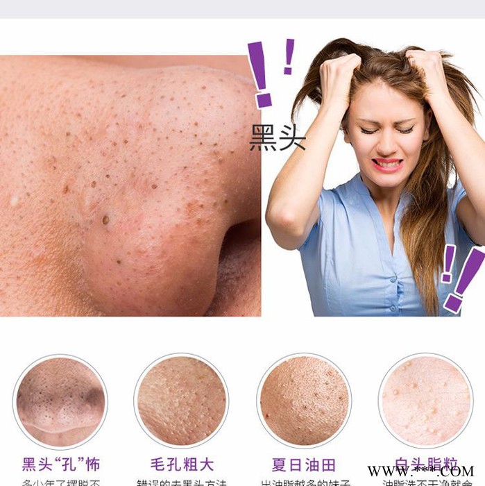 电动吸去粉刺吸黑头小气泡美容仪 黑头清洁仪粉刺仪