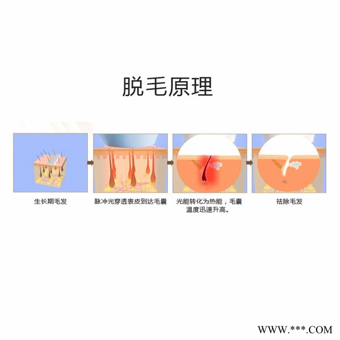 广州欧的美容仪器多功能OPT冰点无痛快速脱毛仪  脱毛嫩肤美白祛斑图3