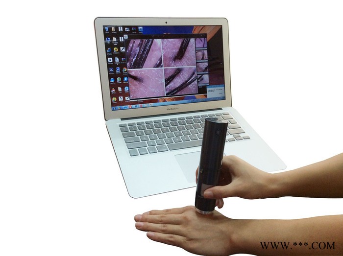 天阅美容仪器皮肤检测仪皮肤测试仪毛囊检测仪头皮检测仪头发检测仪wifi显微镜数码显微镜无线显微镜便携式显微镜便携美容仪图7