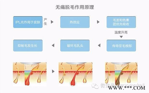 脱毛仪（opt冰点无痛快速滑动脱毛）808脱毛仪 澳玛美容仪器**价格优惠 opt无痛脱毛图4