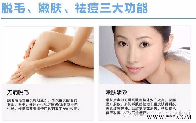 脱毛仪（opt冰点无痛快速滑动脱毛）808脱毛仪 澳玛美容仪器**价格优惠 opt无痛脱毛