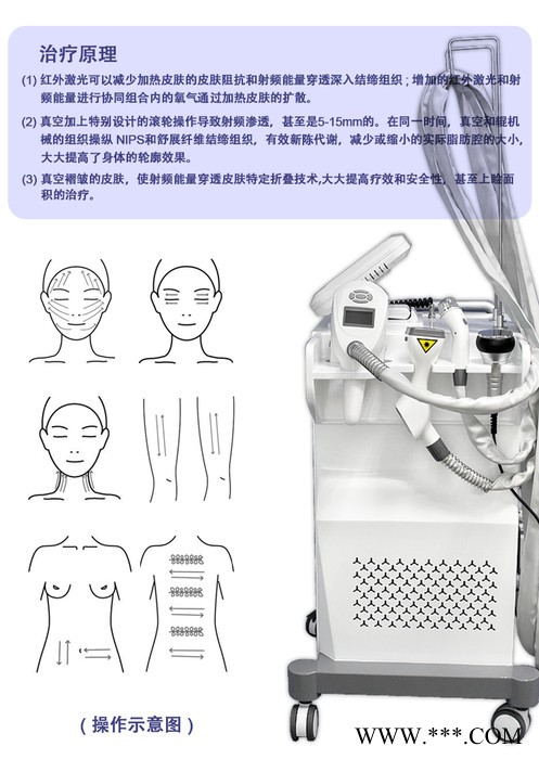 倍腾beir维拉Ｖ68溶脂纤体美容仪紧致抗衰提升负压减肥仪新款图3