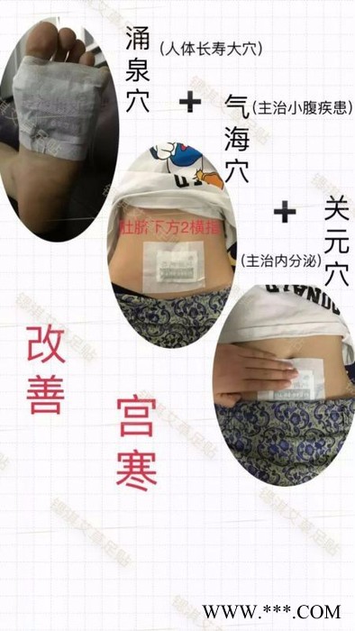 锶淇艾草足贴图3
