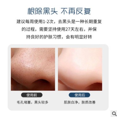 teruiya升级版小气泡去黑头仪毛孔清洁器器家庭祛黑头洁面仪神器图1