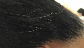 吃得对，白发脱发或许能养好！想要头发又黑又多，不妨试下食疗